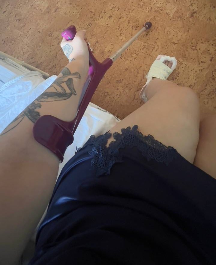 warlike_lady's tweet photo. соседи теперь АхУеЮт с этой прикормки 
а хожу я ооочень много и теперь это сплошное бАм БаМ бАМ бАм БаМ бАМ 
никогда не думала что гипс и его подобие такие тяжелые 🥺 https://t.co/VdtJyMbQPn