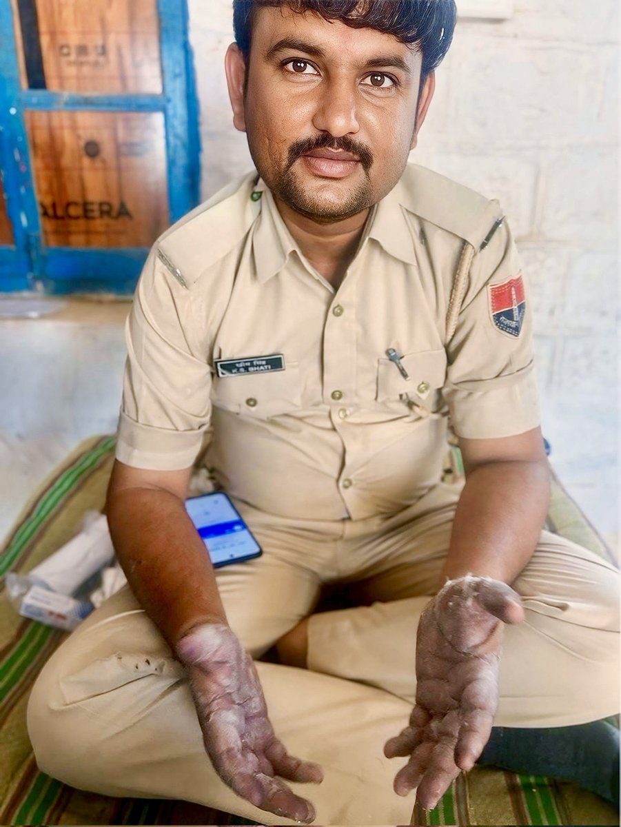 श्री खीमसिंह जी भाटी पुलिस कांस्टेबल जिन्होंने निस्वार्थ, बहादुरी, साहस और सूझबूझ का परिचय देते हुए एक युवक की जान बचाई और उस दौरान वह भी तेजाब से झुलस गए।उन्होंने हार नहीं मानी तथा युवक को अस्पताल पहुँचाकर उसका जीवन सुरक्षित किया।

<a href="/PoliceRajasthan/">Rajasthan Police</a> <a href="/JaisalmerPolice/">Jaisalmer Police</a> <a href="/DmJaisalmer/">Jaisalmer District Collector & Magistrate</a>