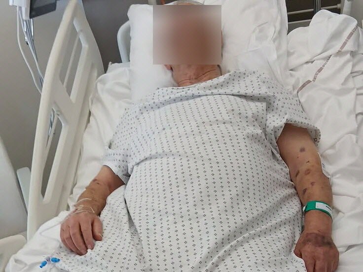 « Il a ruiné les dernières années de vie de notre papa » : Angelo, 86 ans, battu pour sa chaîne en or par un jeune à Lyon (MàJ : Un migrant algerien de 17 ans, interpellé)
 fdesouche.com/2025/08/20/il-…