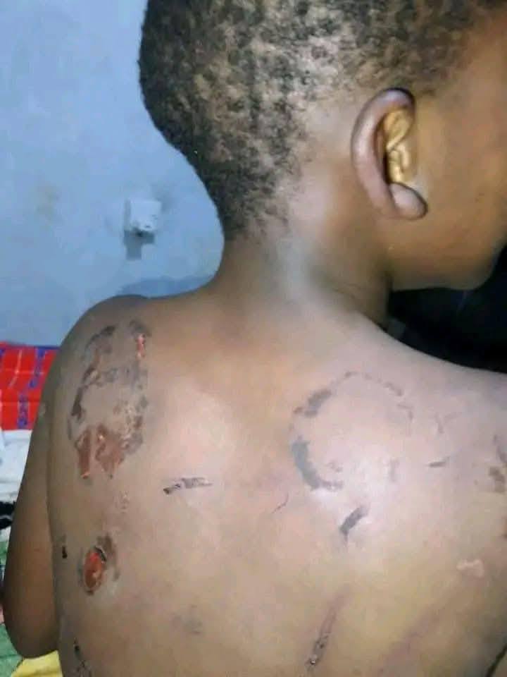 TransitPrime_'s tweet photo. 🚨 Heartbreaking 🚨
A 9-year-old boy was brutally beaten &amp; burnt with a red-hot knife by his own mother after coming home late. 💔
This is child abuse &amp; must never be ignored. Justice must be served!

Koome Kissed MP, Githurai, Yakohama, AFCON 2027 https://t.co/3RwFgqyxFq