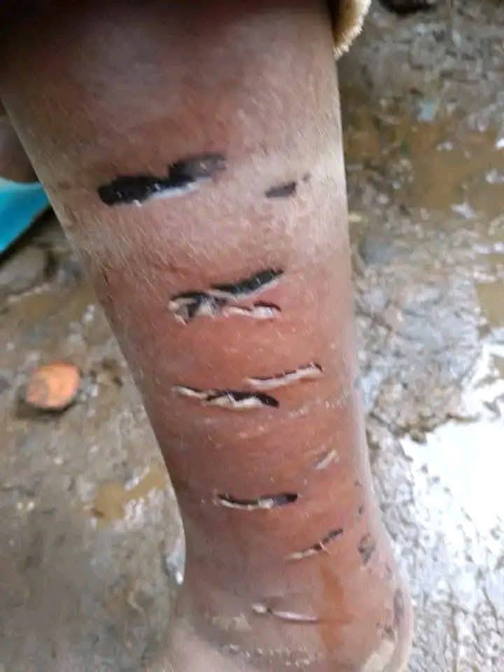 TransitPrime_'s tweet photo. 🚨 Heartbreaking 🚨
A 9-year-old boy was brutally beaten &amp; burnt with a red-hot knife by his own mother after coming home late. 💔
This is child abuse &amp; must never be ignored. Justice must be served!

Koome Kissed MP, Githurai, Yakohama, AFCON 2027 https://t.co/3RwFgqyxFq