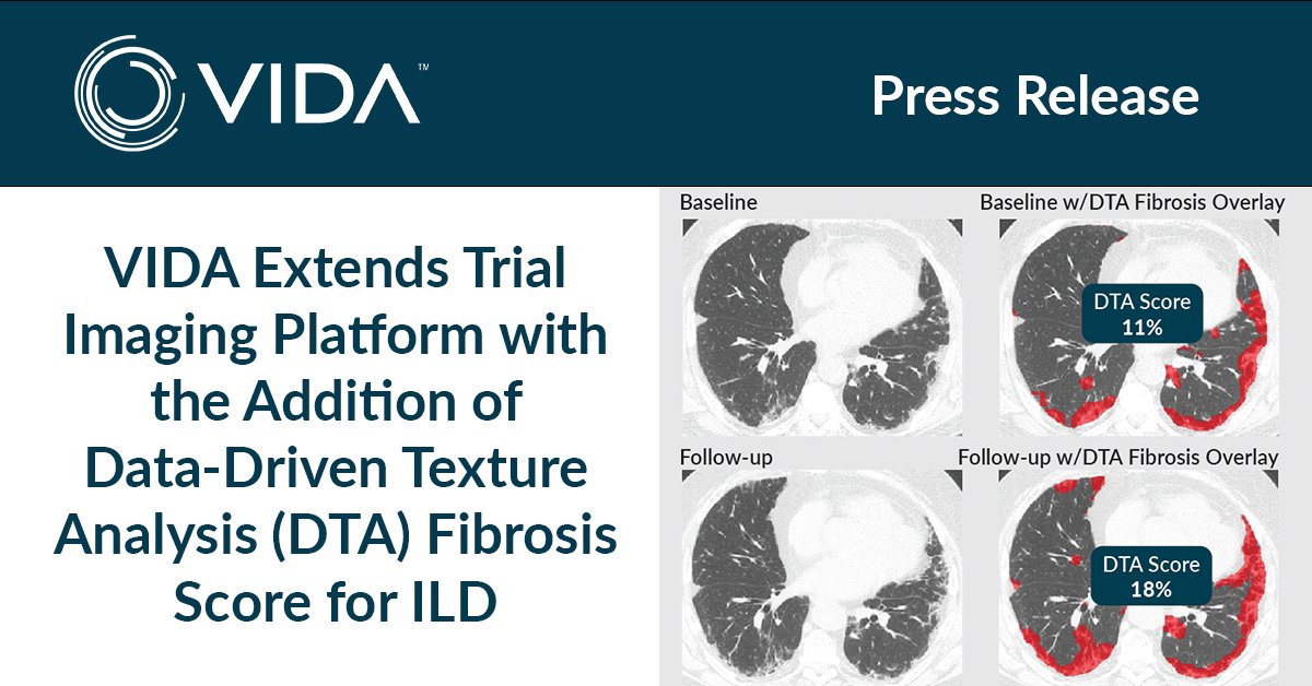 We are excited to announce the addition of DTA Fibrosis Score for ILD, extending the capabilities of our trial imaging platform. Full announcement here: hubs.la/Q03DDzzv0
#IPFSummit #ILD #Fibrosis