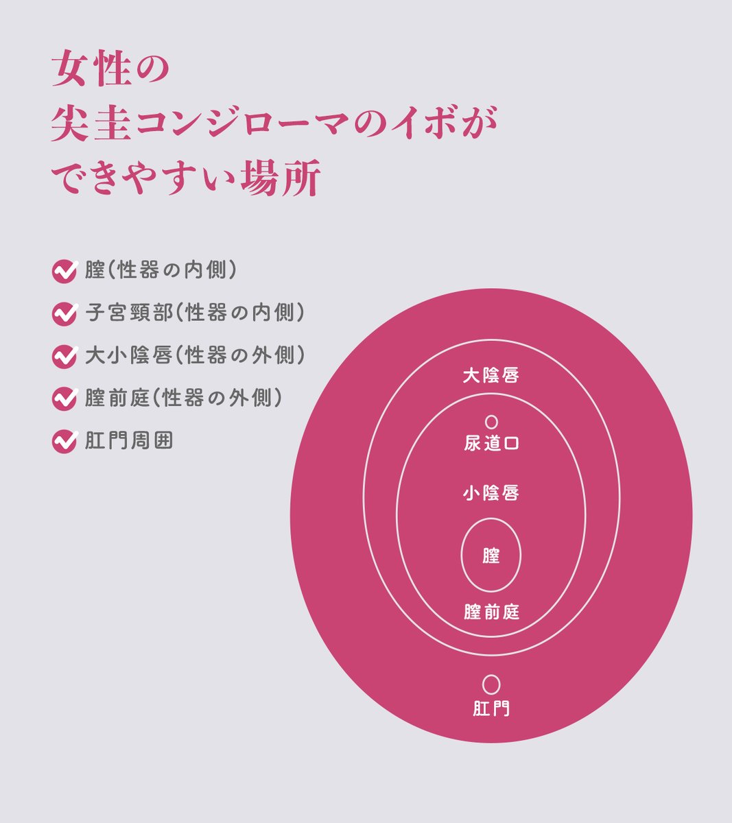 tokyo__himitsu's tweet photo. 男性と女性で違う？尖圭コンジローマができやすい場所まとめ！

#性病 #HIV #HPV #尖圭コンジローマ #梅毒  #性教育 #健康相談 https://t.co/WgrBXuoztg
