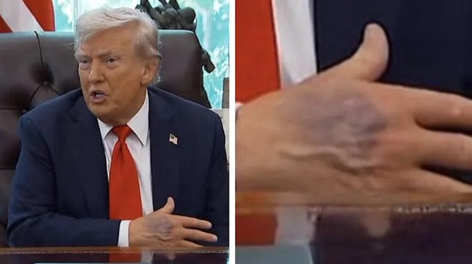 最近btc下跌应该是受到了特朗普中风这个消息的影响了，如果Trump要是死了，那大波动就要来了🤣今天Trump出来公开讲话，可以看看他的状态怎么样。

观点如下：