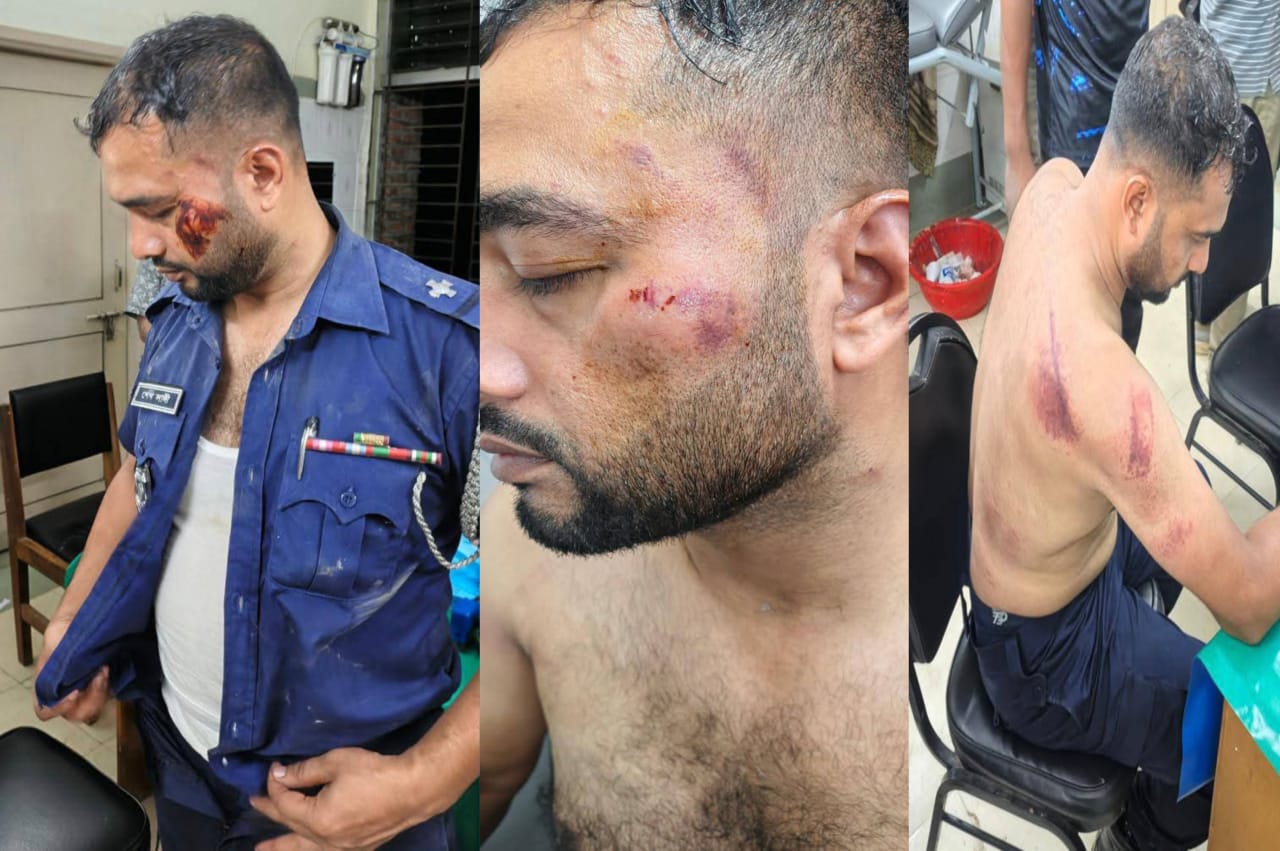 বিজয়নগরে ওয়ারেন্টের আসামী ছিনিয়ে নিতে পুলিশের উপর হামলা, ৬ জন আহত