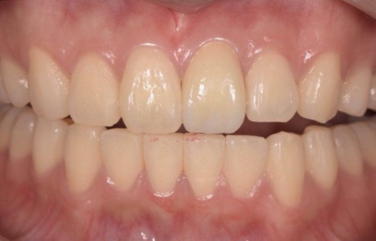 株式会社グローバルナイン tweet media