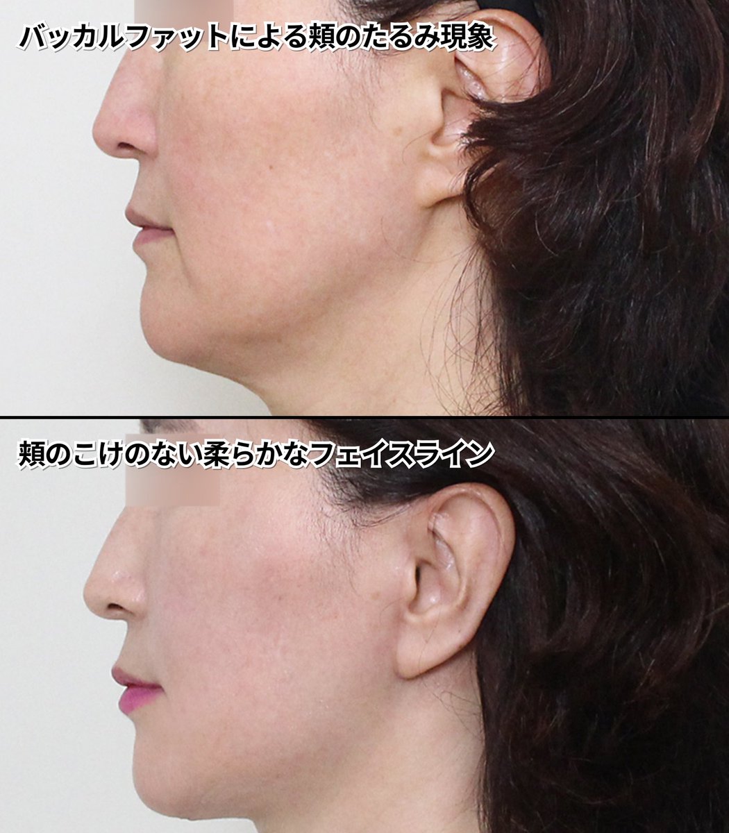 【切開リフト・脂肪吸引専門】 スターライン美容外科 tweet media