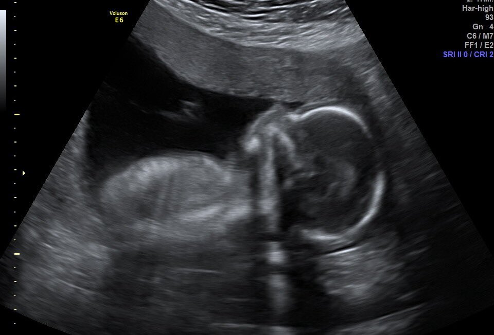 pixie3lilyyy's tweet photo. This was the most amazing and special day ever 🥹 I’m so grateful . #genderreveal https://t.co/JhOHmefWHM