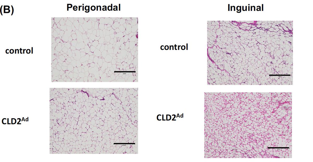 UTSWdiabetes's tweet image. Congratulations to Beth Griesel from the Sparling Group at the University of Oklahoma Health Sciences to the publication of her work on CRISPLD2, a novel insulin-sensitizing adipokine that can affect adipocyte size! Increasing CRISPLD2 expression from adiposity can decrease…