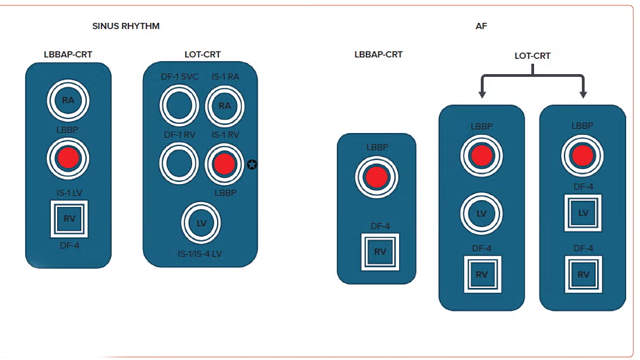ArrhythmiaAcademy tweet media