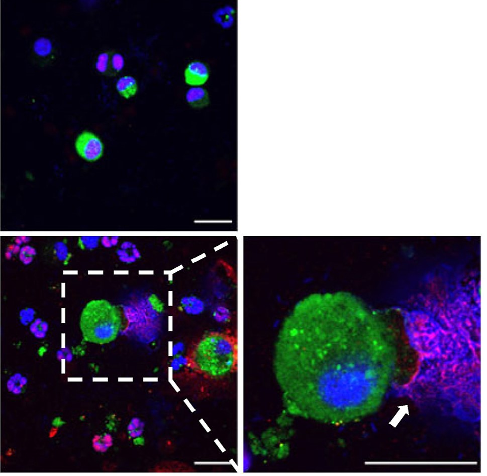 AJPathology's tweet image. #LegacyContent: Macrophage Extracellular Traps Suppress Particulate Matter–Induced Airway Inflammation
Free in the #OpenArchive: ajp.amjpathol.org/article/S0002-…