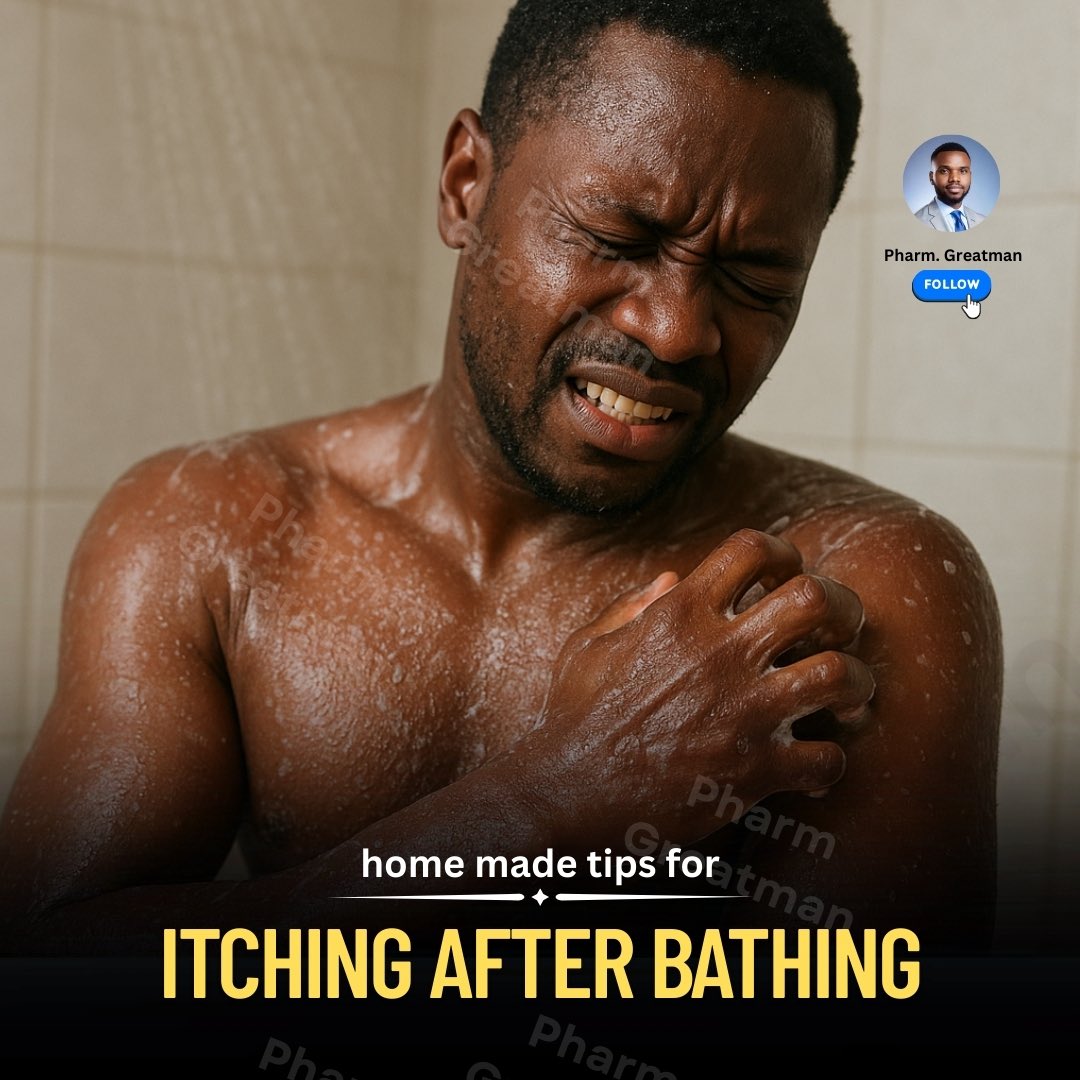 Do you feel itchy every time water touches your skin?

You may have a rare condition called aquagenic pruritus. It does not cause rashes but leads to intense itching after contact with water. 

Check my comments below 👇🏾 for few home tips that may help:

A thread