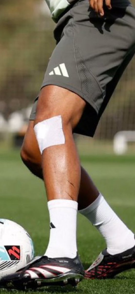 milla_ms1's tweet image. So when will they wrap him in bubble wrap?