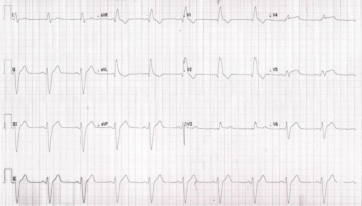 EM case of the week: Heartburn
erpocketbooks.com/more-mysteries…
