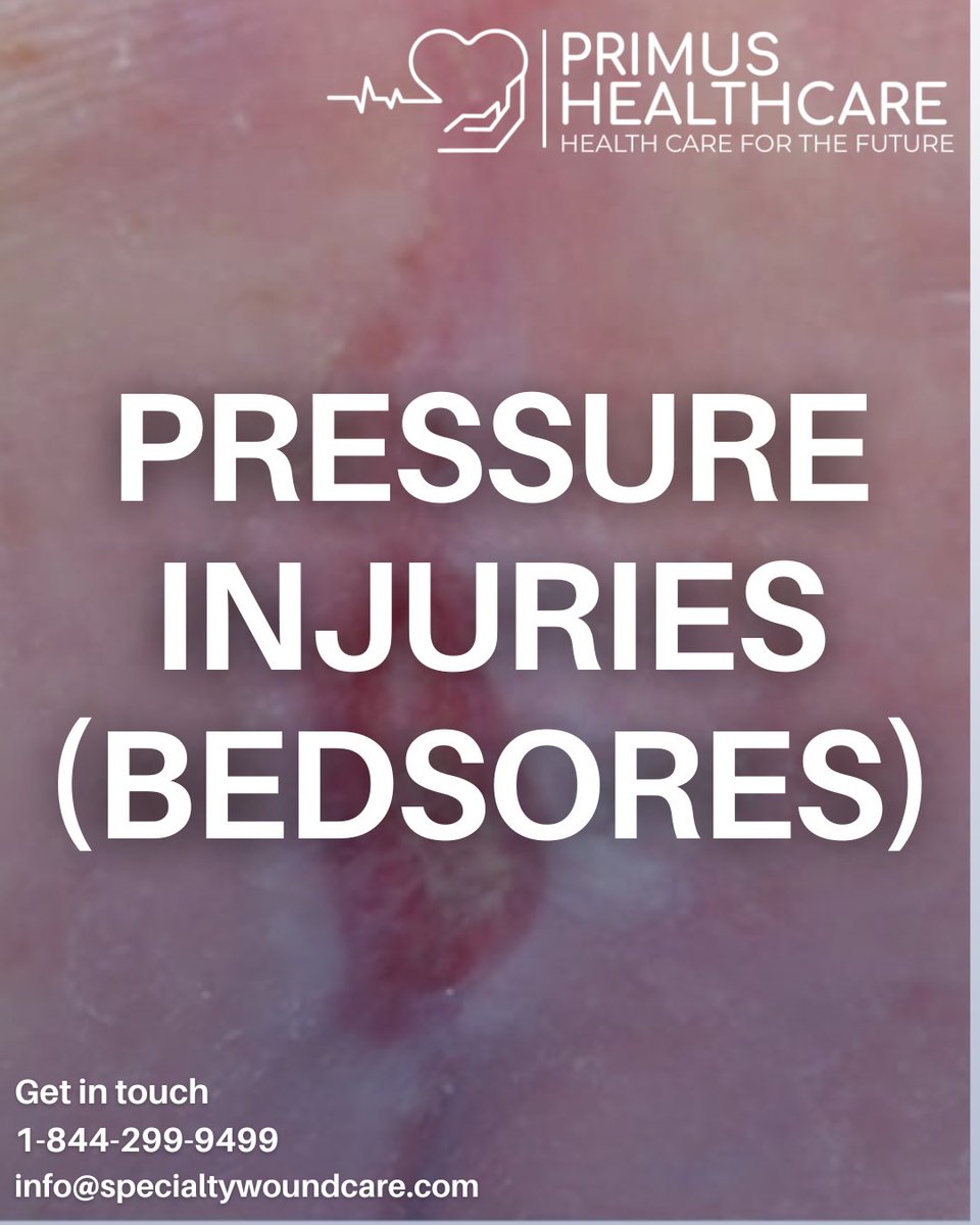 SpecialtyWound's tweet image. 🛏️ Pressure injuries—also known as bedsores—develop when constant pressure reduces blood flow to the skin, usually over bony areas like the hips, heels, or tailbone.

#PressureInjuries #Bedsores #SpecialtyWoundCare #WoundHealing #ChronicWounds #HealthySkin #AdvancedWoundCare