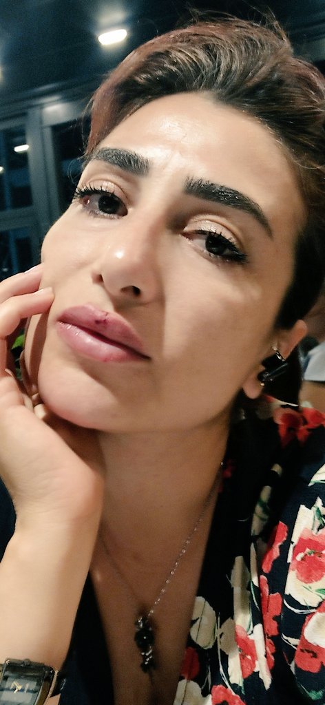 Hacrzdmr4756's tweet photo. Ne kadar kem ve kenafir gözler yüzünden dudağım gözüm nazara gelmis olsa da inadına gülüp geçiyorum Rabbim kem ve gözlerden korusun #amin 🙏 #Ecmain 🙏 https://t.co/FebmdeSeRa