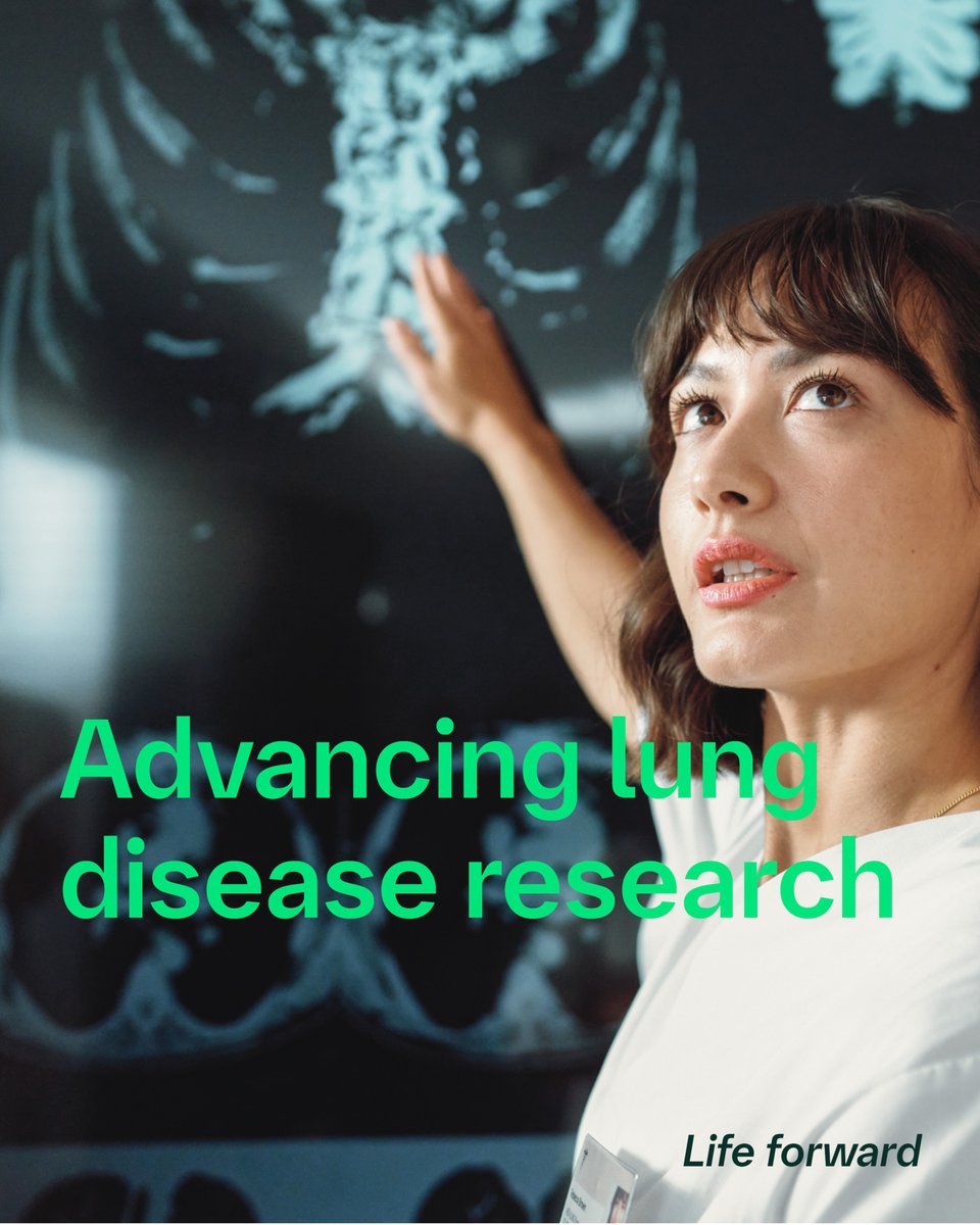 We’re teaming up with <a href="/HelmholtzMunich/">Helmholtz Munich | @HelmholtzMunich</a> to advance fibrotic lung disease research. As leaders in fibrotic lung disease, we’re pioneering new therapies and striving towards our ultimate goal of finding a cure.

Learn more: go.boehringer.com/HP-j5

#LungHealth #IPF #Collaboration