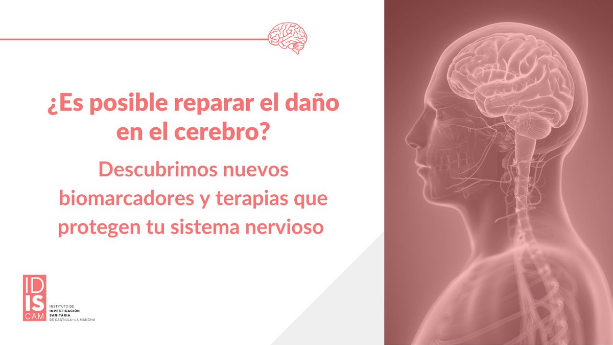 🔍 ¿Podemos reparar el daño en la esclerosis múltiple? 

Investigamos terapias innovadoras para proteger el sistema nervioso y mejorar la calidad de vida. 

Avanzamos por ti 💙 idiscam.es/investigacion/…