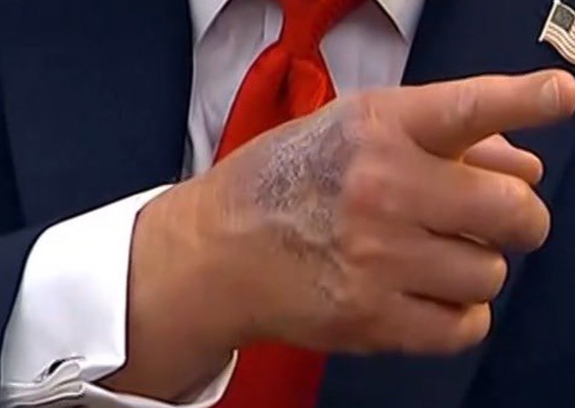 rockingrobin2's tweet image. If he's not talking  it's because he can't.  He's not well. Still awful government management because he's desperate and not in charge sick or well. At 79  a hefty daily diet of hamburgers and hate will make you sick. Where is @jaketapper #JakeTapper