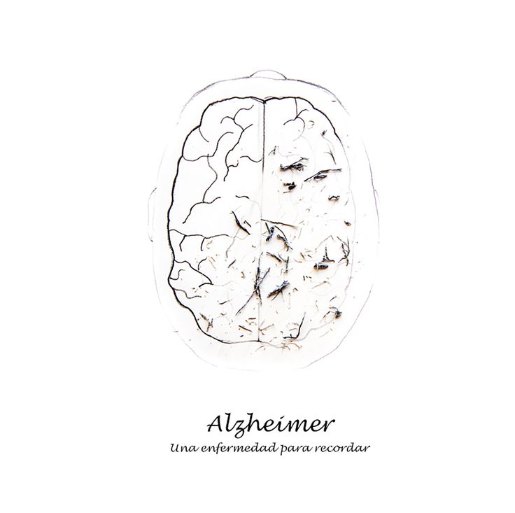 Alzheimer, una enfermedad para recordar