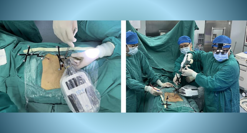 ODTmagazine's tweet image. First miniature spinal #surgicalrobot approved in China: hubs.li/Q03GsQmP0

#surgicalrobotics #spinesurgery