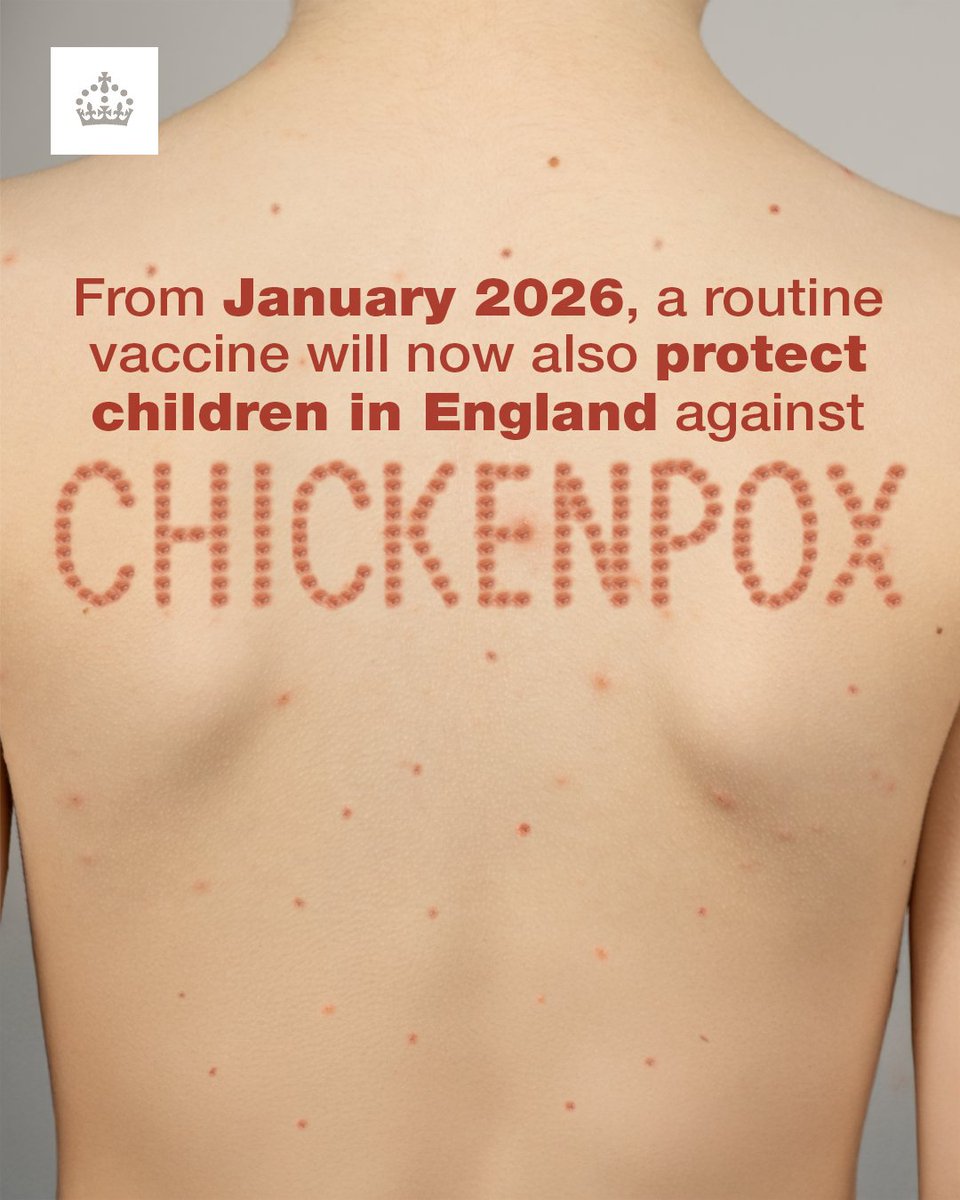 UK Health Security Agency (@ukhsa) on Twitter photo ICYMI: From January 2026, a free #chickenpox vaccination programme will protect around half a million children each year.
Eligible children will get an #MMRV vaccine to protect against #measles, #mumps, #rubella and chickenpox.
Read the full story here: bit.ly/4lZ14Bp ICYMI: From January 2026, a free #chickenpox vaccination programme will protect around half a million children each year.
Eligible children will get an #MMRV vaccine to protect against #measles, #mumps, #rubella and chickenpox.
Read the full story here: bit.ly/4lZ14Bp