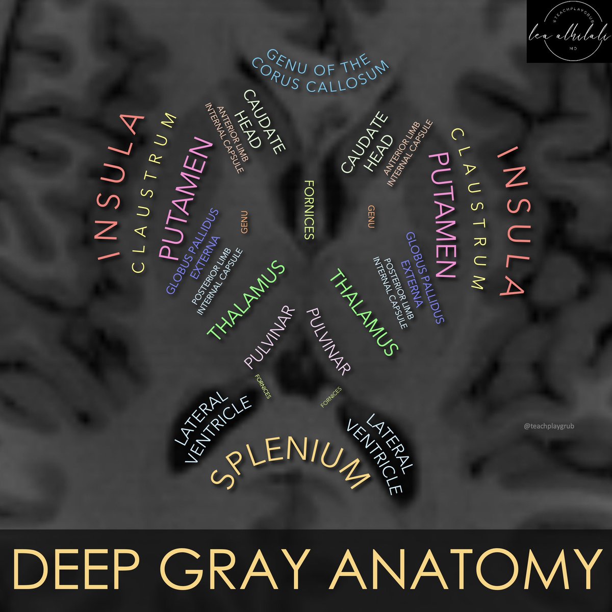 Want to dive deep into deep gray anatomy??

Here’s how to remember the basics:

Deep gray structures look like a sad face—remember they are feeling sad or gray!!

Caudates are the eyes: remember both Cornea and Caudate start with C

Putamina are the cheeks: Remember both Putamen
