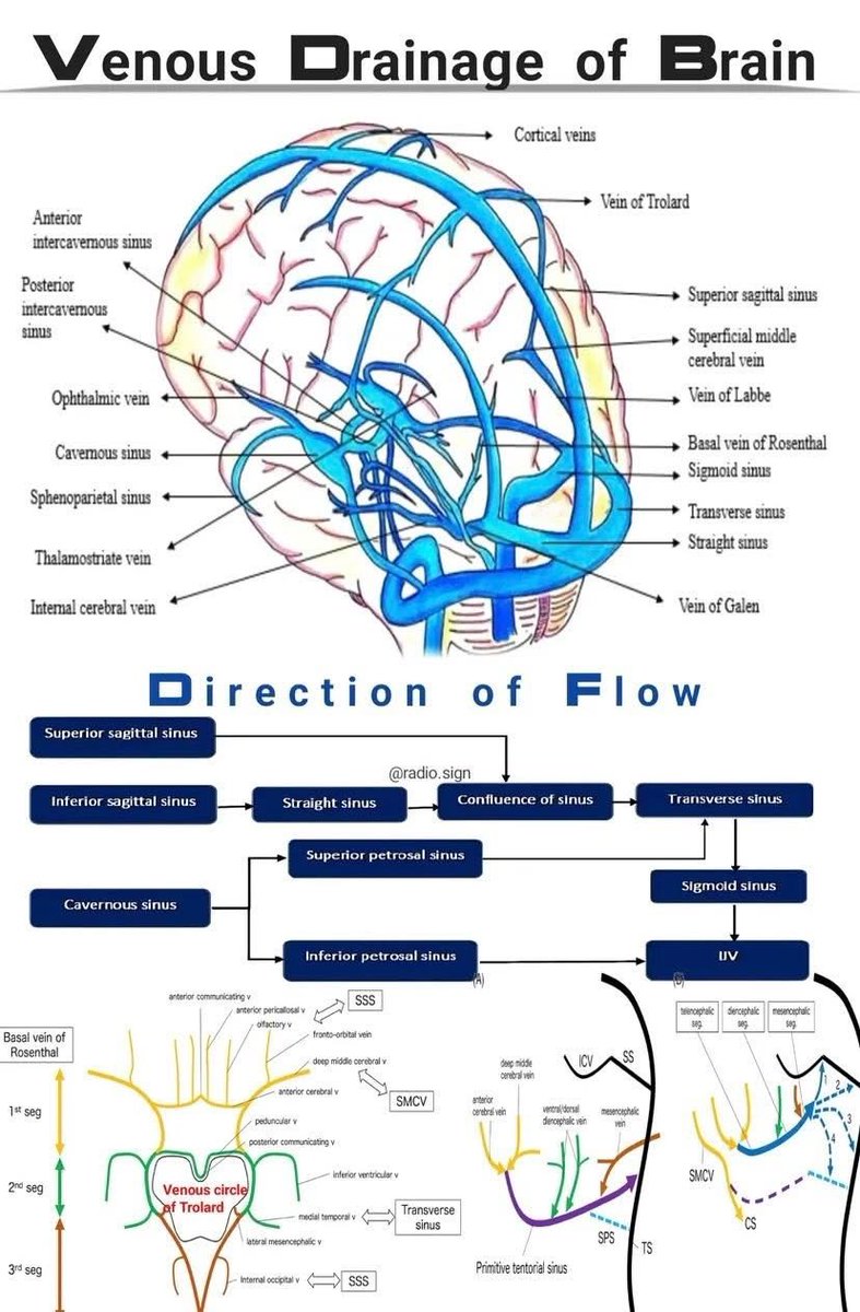OGdukeneurosurg's tweet photo. Brain drain https://t.co/aXFv7XmqV1