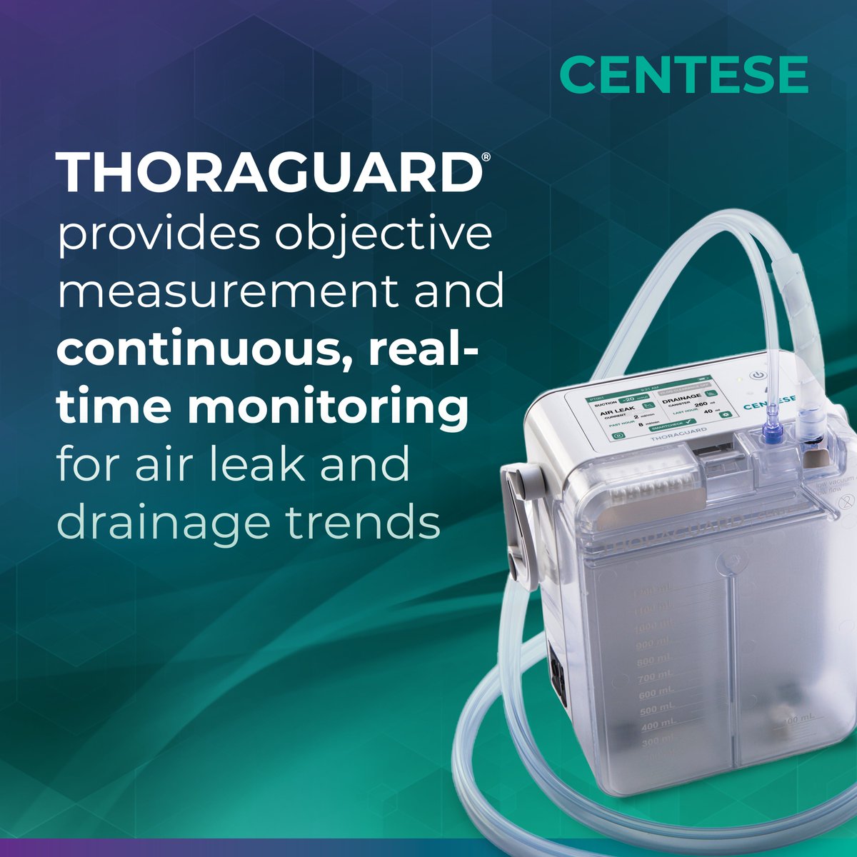 With Thoraguard, #thoracic surgery teams can leverage data for objectivity with continuous digital monitoring of air leaks and fluid trends at the bedside.

Learn more at Centese.com.