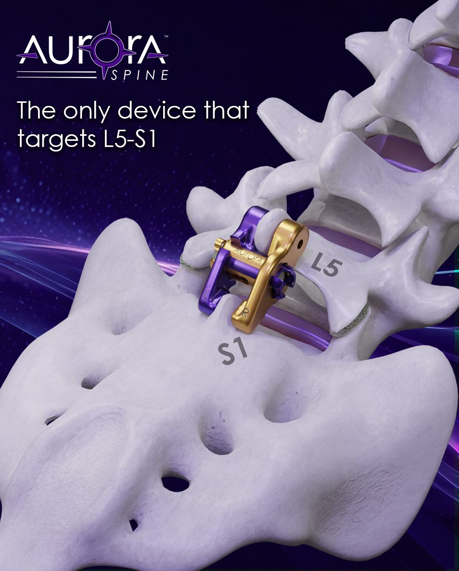 Featuring a secured locking mechanism, no need for pedicle screws.
Zip™ offers a screwless and reliable alternative.

hashtag#PainManagement hashtag#ZipProductLine hashtag#MinimallyInvasive hashtag#spinalfusion