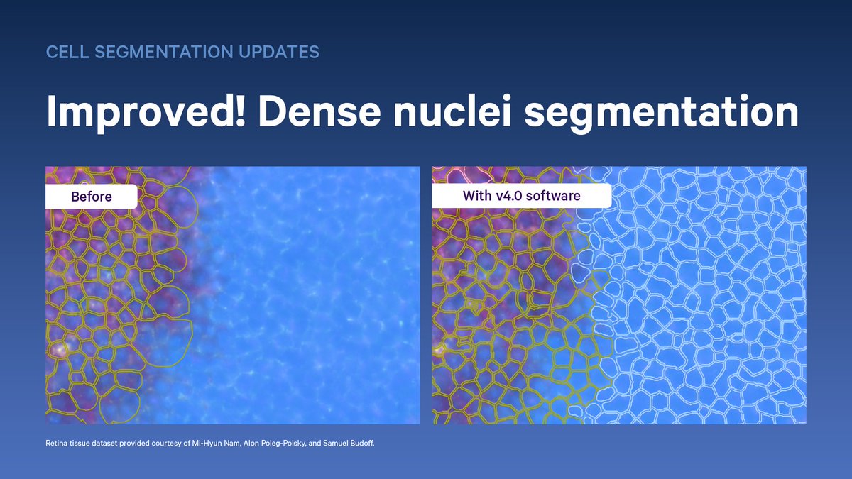 10xGenomics's tweet image. Accurate cell segmentation is integral to #spatialtranscriptomics—that&apos;s why we never stop improving ours. Large cells? Tissues with dense nuclei? We’ve got you covered. See how you can segment cells more accurately than ever before: bit.ly/4m1nEcz