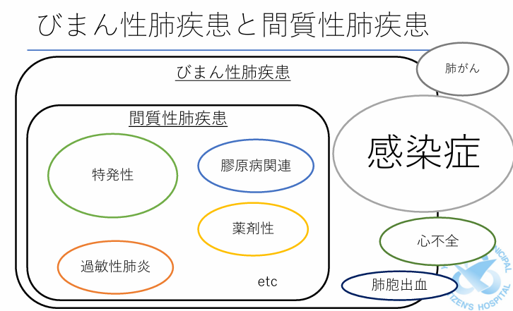 びまん性肺疾患」ってイメージできる？ どんな原因かわかる？ びまん性