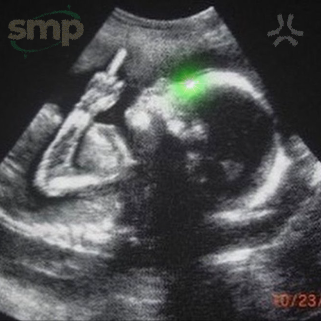 blocking the next person who has a baby and refers to it as a "mint"