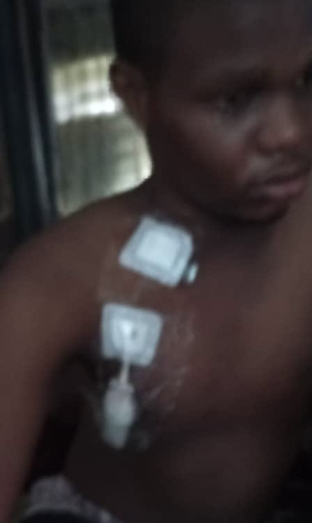 Dear NIUK Family, I need your support.

My 19-year-old nephew, Izunna, a Theatre &amp; Arts student at UniCal, is battling end-stage kidney failure. He’s now on dialysis with a chest line inserted after his leg access failed. He’s in pain but holding on with hope. 💔