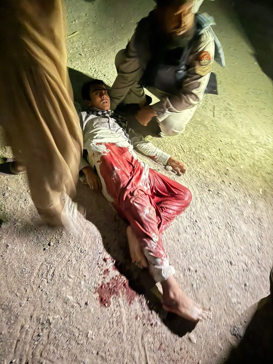 کوئٹہ میں دھماکہ میں کئی ورکرز شہید اور کئی ورکرز زخمی 😭😭