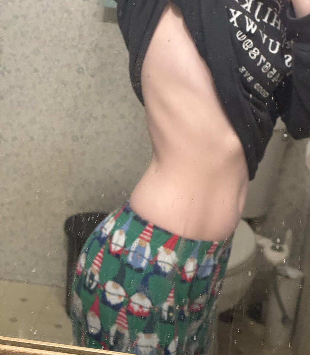 VAL🦄 (worlds worse anorexic) tweet media