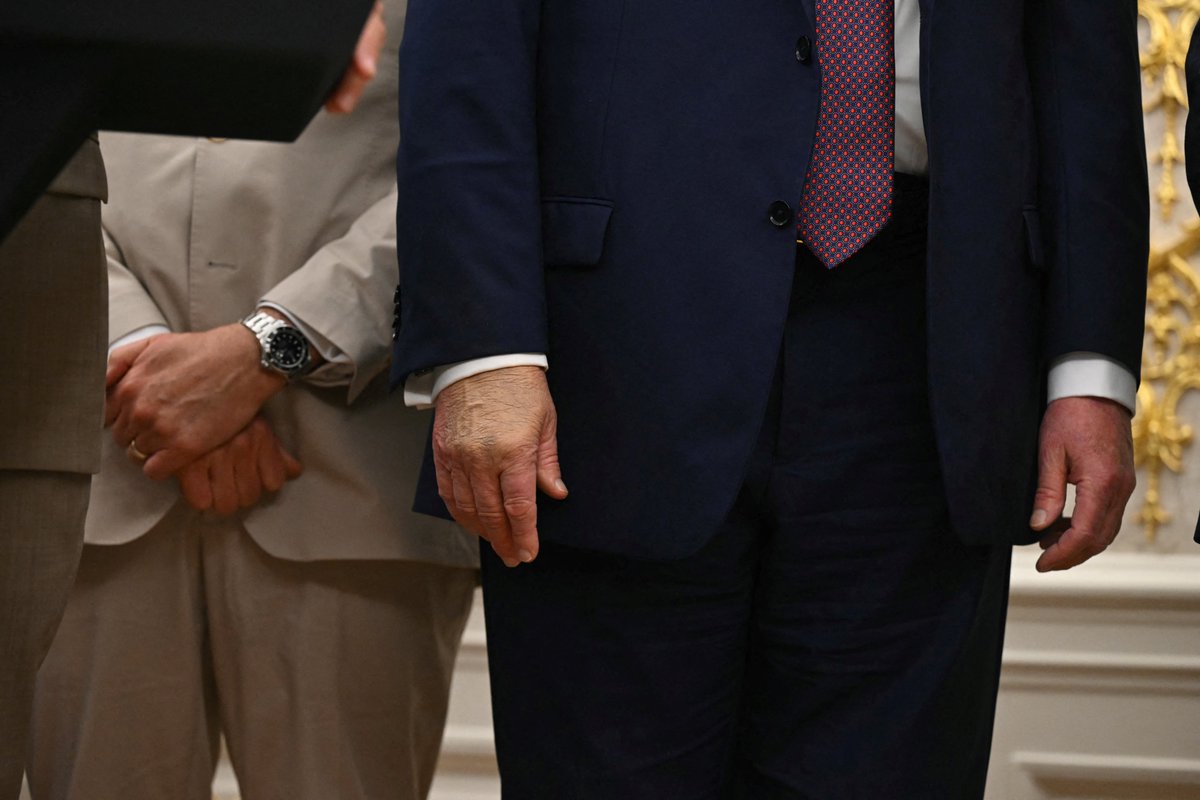 photos of Trump's hand today

(via Getty)