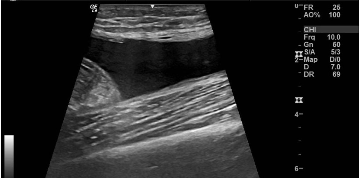 Anton Matveev, MD, RMSK tweet media