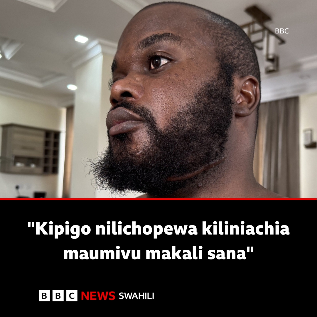 'Walinipiga risasi na kunitelekeza wakidhani nimekufa' – mmoja wa mateka Tanzania aeleza kilichomkuta

bbc.in/3HXZvph