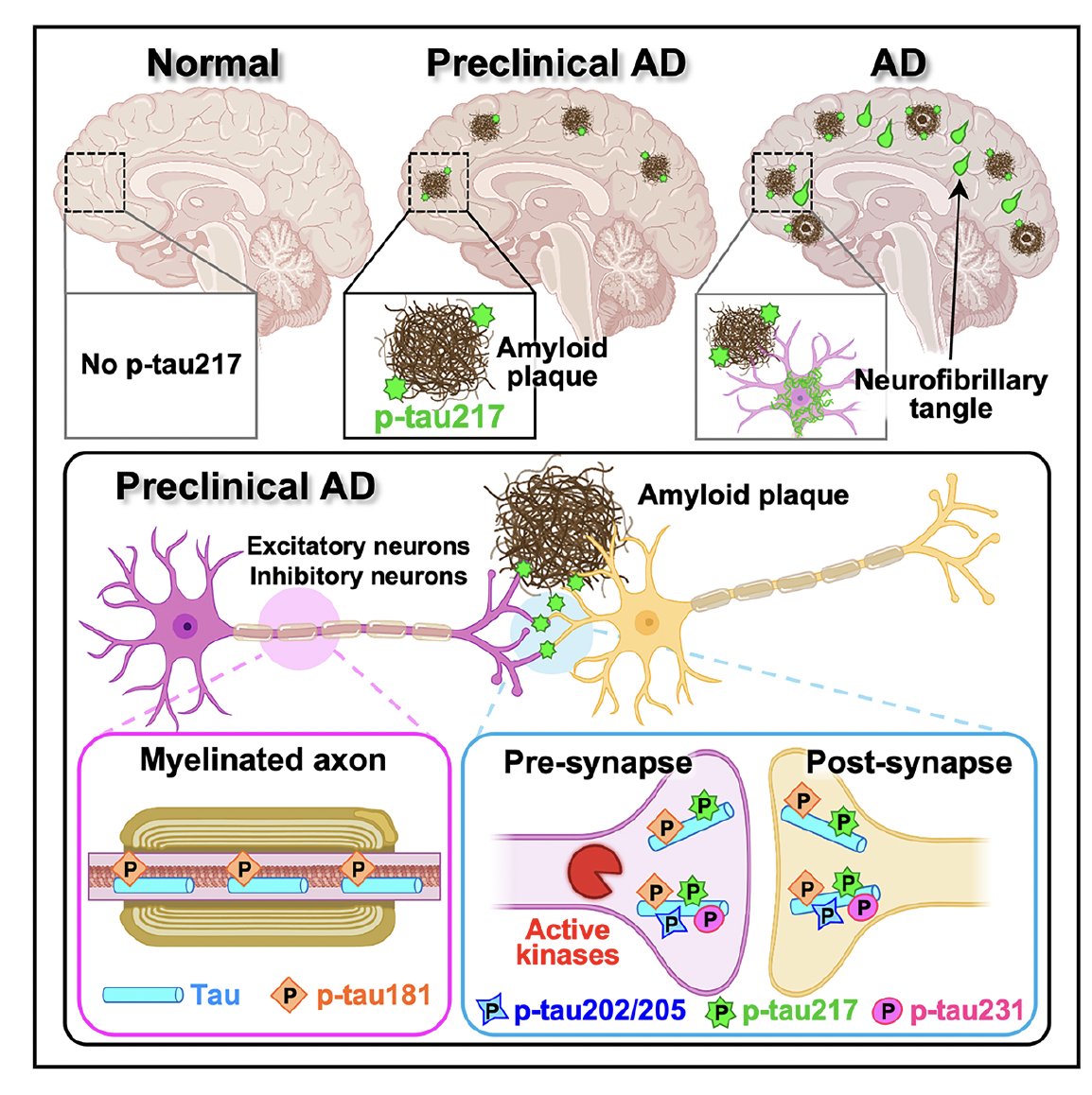 EricTopol's tweet photo. On Alzheimer's disease today:
—Where p-tau217 is found in the brain and what it means
—p-tau 217 is the most sensitive and specific AD biomarker, systematic review 
—Amyloid-β in brain and the gut's immune system https://t.co/qugc7ShNp2