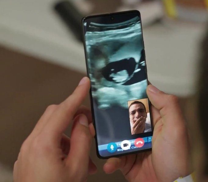Hands holding a smartphone displaying a video call. The screen shows an ultrasound image and a small inset of Afonso with a surprised expression. Video call interface buttons like Mute and End Call are visible.
