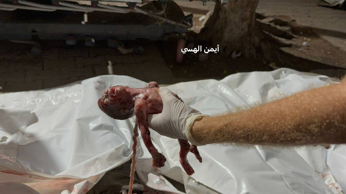 🚨BREAKING | Among them an unborn baby, 5 victims and several injured have arrived at Al-Shifa Medical Complex after an Israeli strike targeted an apartment near the fishermen’s port in western Gaza City.