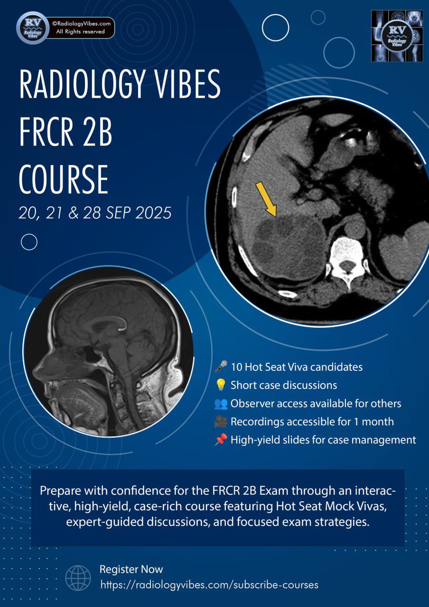 FRCR 2B Online Viva Course
📅 20–21 &amp; 28 Sept 2025 | 💻 Zoom | ⏱️ 4 hrs/day | 🕑 From 2 PM UK

⚡️ 30-min Hot Seat Vivas with feedback (10 in total)
🥇 Short case strategies 
Link for September Course registration:
radiologyvibes.com/subscribe-cour…