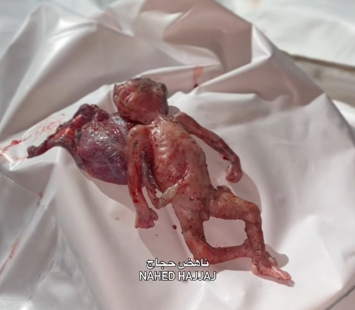 Humanity check.
If you see this pic, PLEASE reply with 🇵🇸 spread it 💔