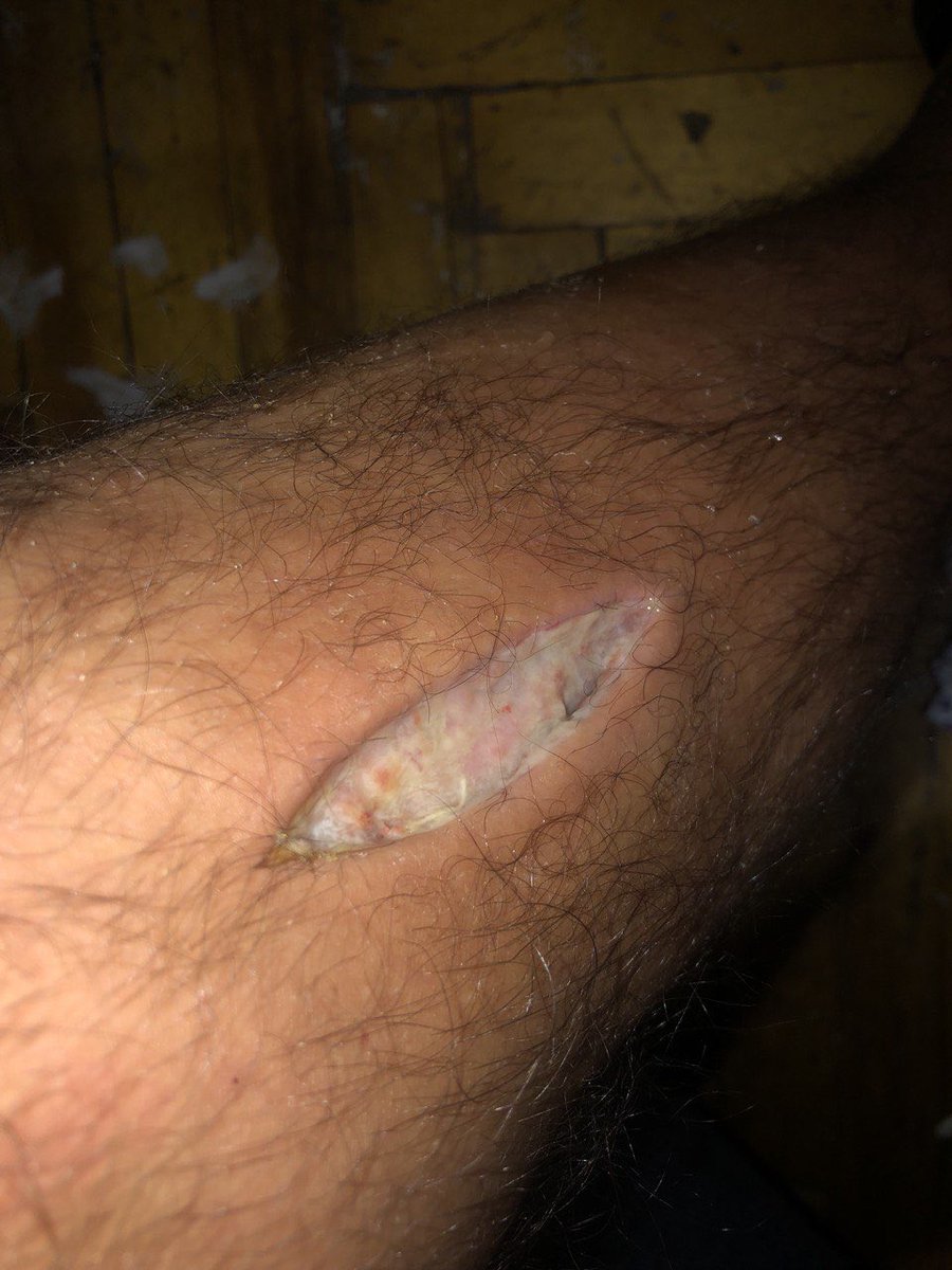 insanebb tweet media