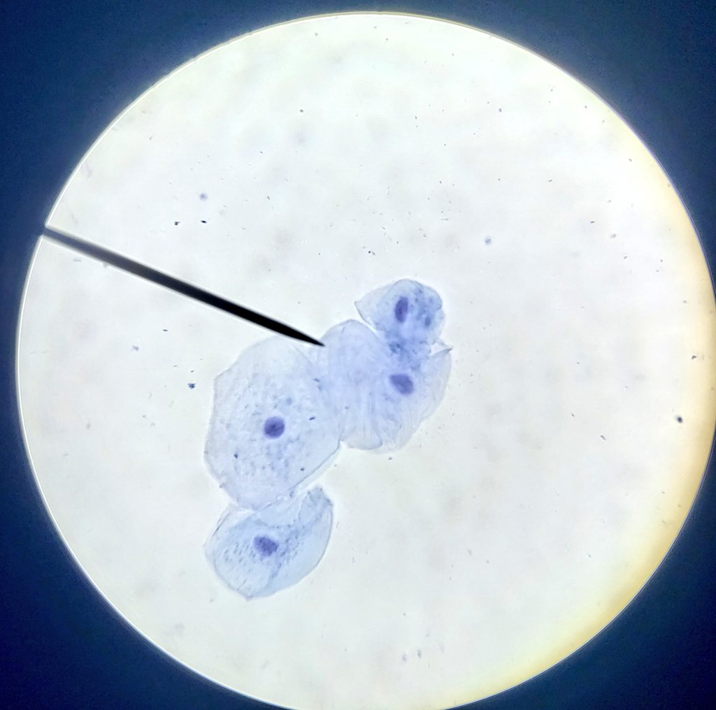 1ères observations cellulaires au labo de SVT ce mercredi : neurone, cellules de l'épithélium buccal ou les 2 ? #microscope