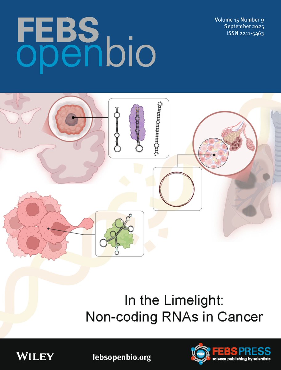 FEBSOpenBio's tweet image. 🍂 Our September Issue is out🍁 

📣 This “In the Limelight” issue features Review articles on non-coding RNAs in cancer, as introduced by Guest Editor Marcin Majka 

🖱️ Access it here
🔓buff.ly/Ay5RGfz

#RNAbiology #NoncodingRNA #ncRNA #Oncology #CancerResearch