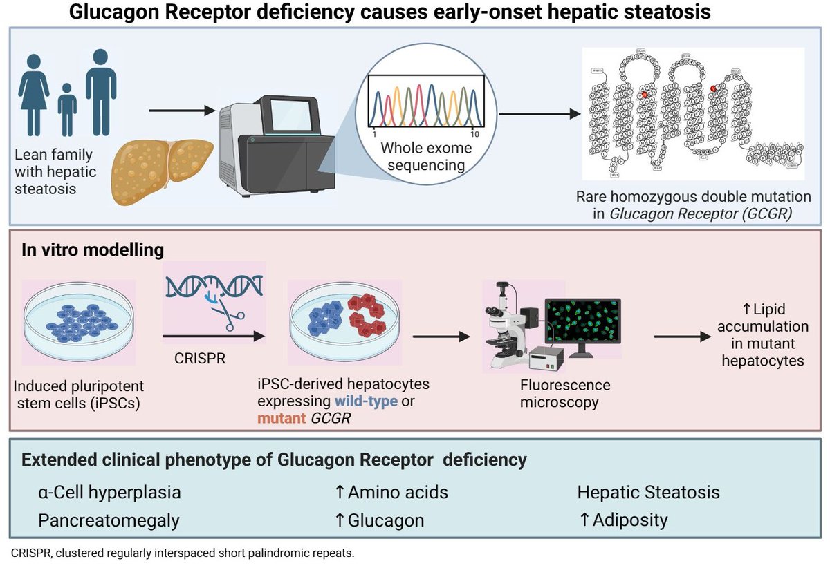 #1
In a paper just published online in Diabetes, we showed that homozygous loss-of-function mutations in the Glucagon receptor (GCGR) cause early-onset hepatic steatosis in people.
DOI: doi.org/10.2337/db25-0…