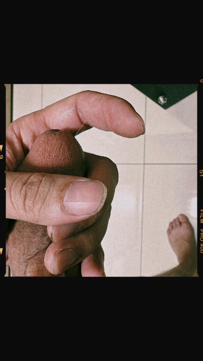 7N38896366's tweet photo. 每次自己來弄成這樣一直吐口水
看起來真的很變態… https://t.co/0sprgkd0Rw