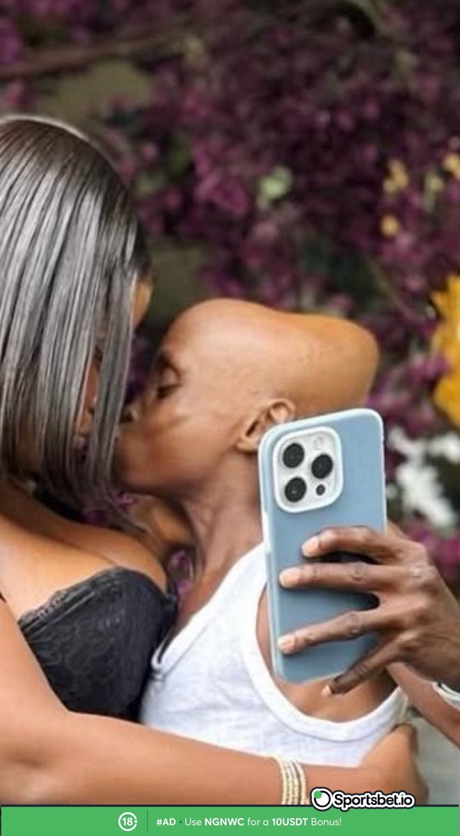 __CD2's tweet image. For my life i never see this kind head😭